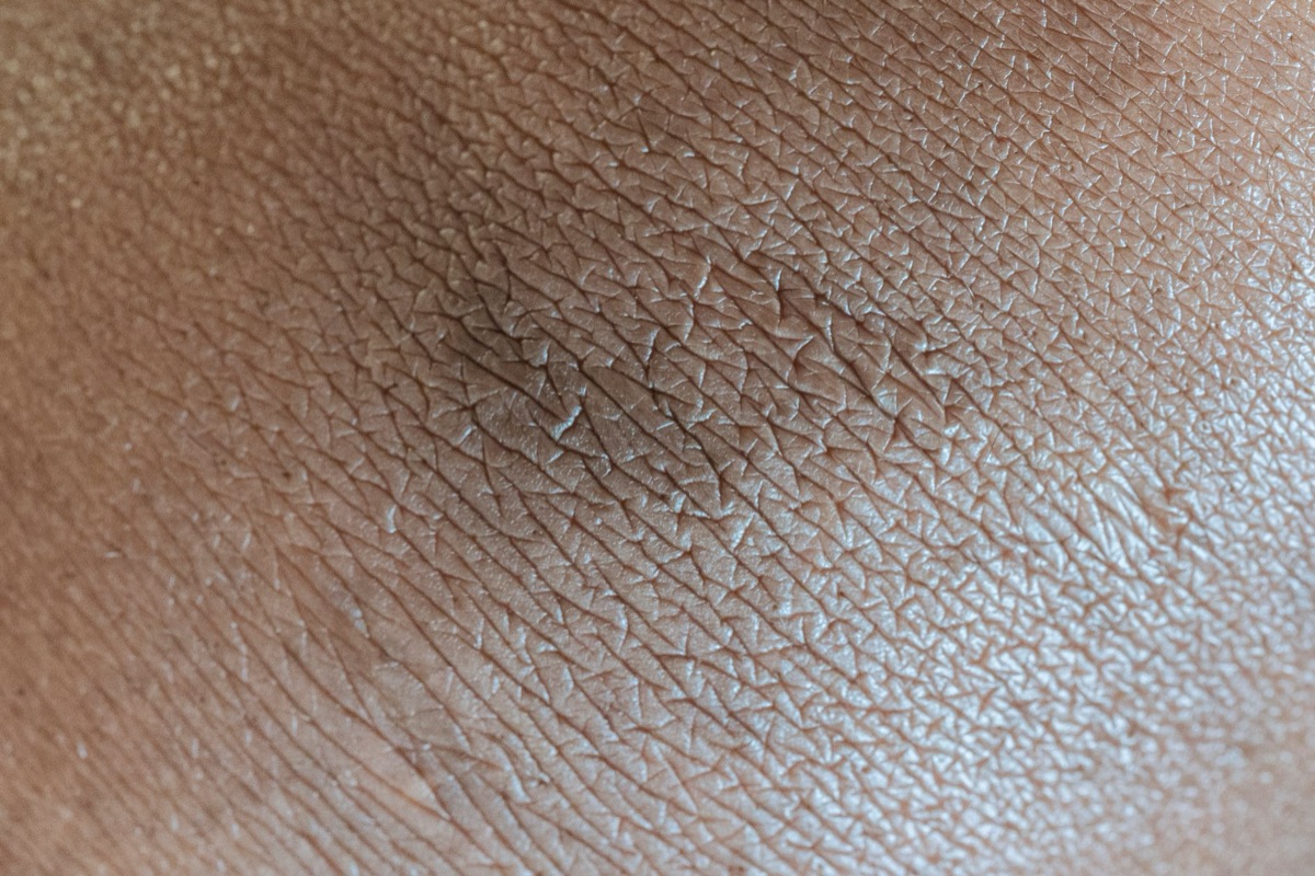 Pele seca tips: como proteger barreira cutânea com 1 dica