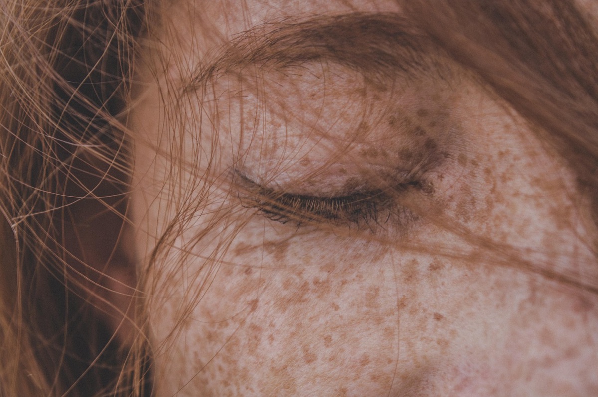 Acne-prone skin with gentle skincare routine in morning light